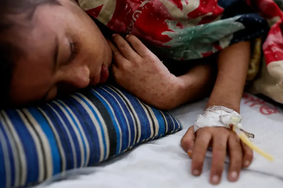 Bangladesh Measles Deaths Reach 1,147 as Vaccination Drives Miss Millions of Children